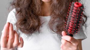 Causes of Hair Fall in Girls