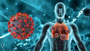 How to Boost Immune System Fast